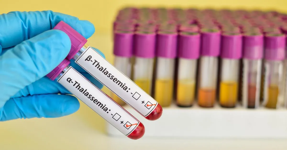 चाईबासा में थैलेसीमिया के चार और बच्चे HIV-पॉजिटिव, जांच जारी