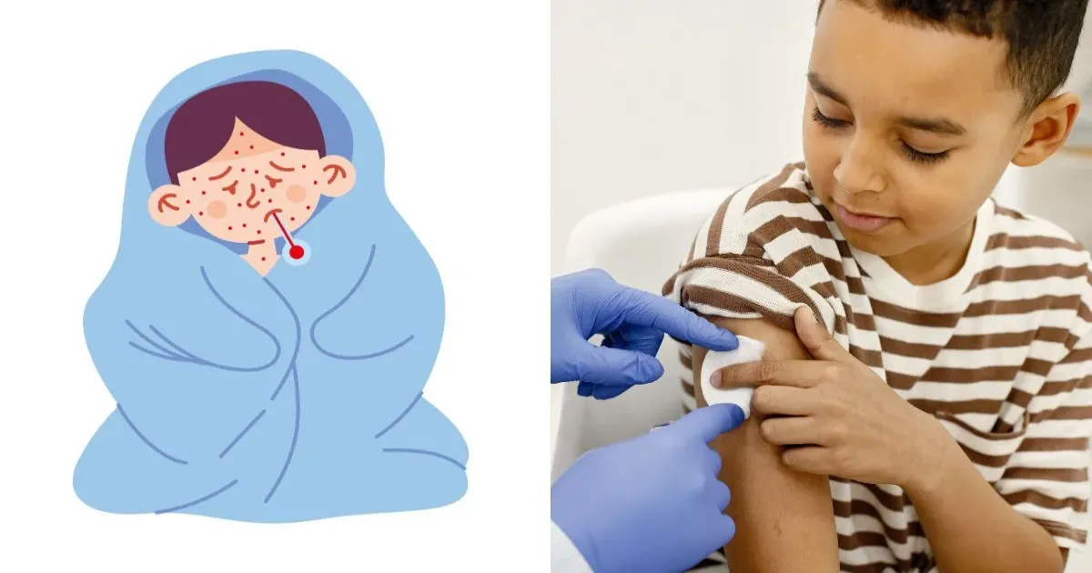 बांग्लादेश में मीजल्स का प्रकोप: भारत को सतर्क रहने की आवश्यकता, विशेषज्ञ का सुझाव