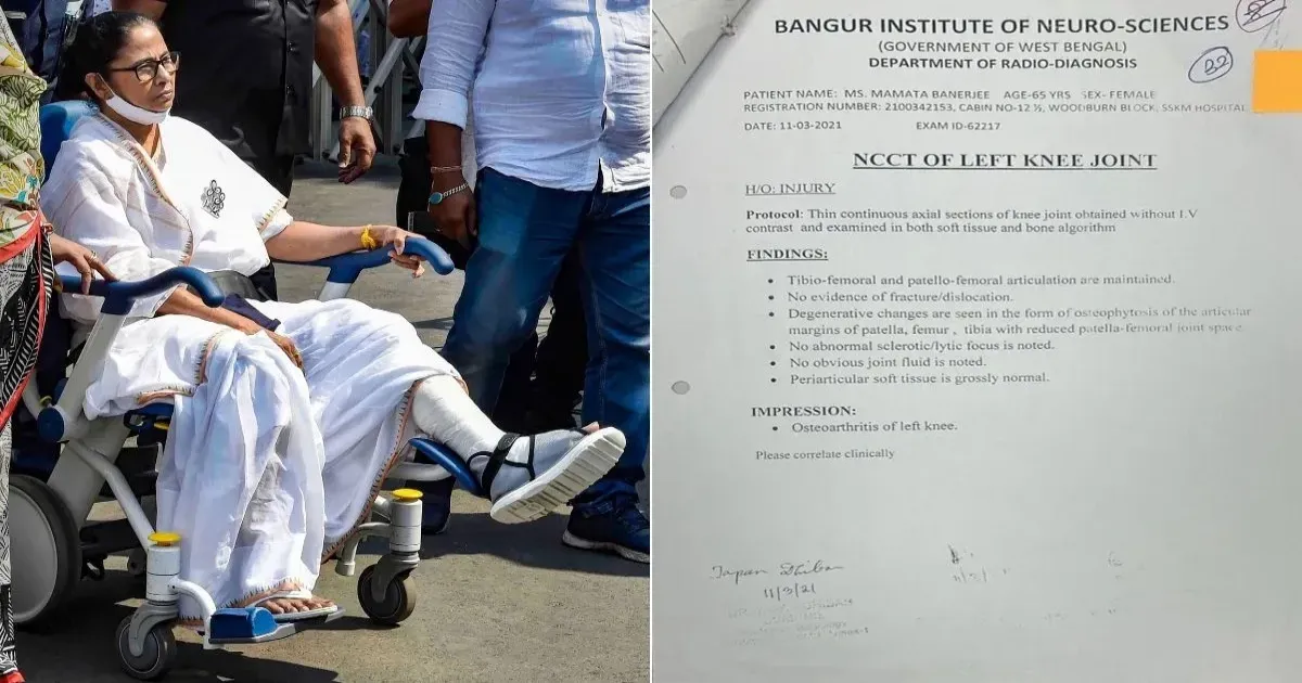ममता बनर्जी की मेडिकल रिपोर्ट लीक होने पर विवाद, एसएसकेएम अस्पताल को कानूनी नोटिस