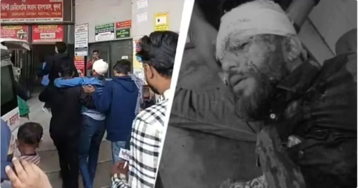 हादी के बाद बांग्लादेश के एक और छात्र नेता के सिर में गोली, हालात गंभीर