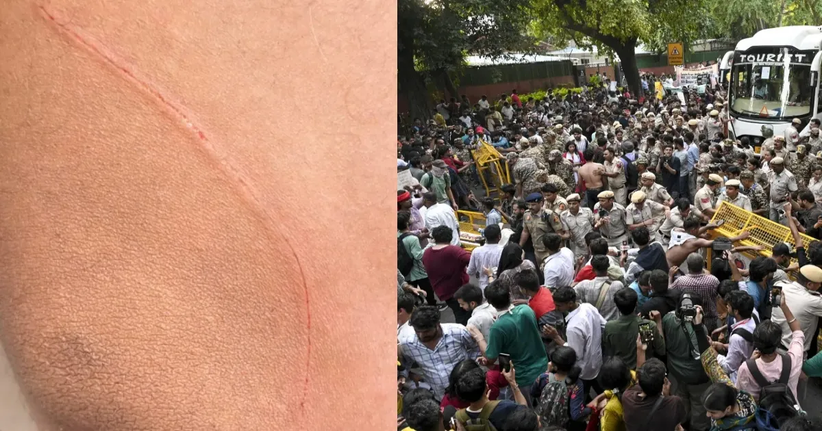जंतर-मंतर पर NSUI प्रदर्शन के दौरान पैरामिलिट्री जवान पर चाकू से हमला, कार्यकर्ता पर आरोप