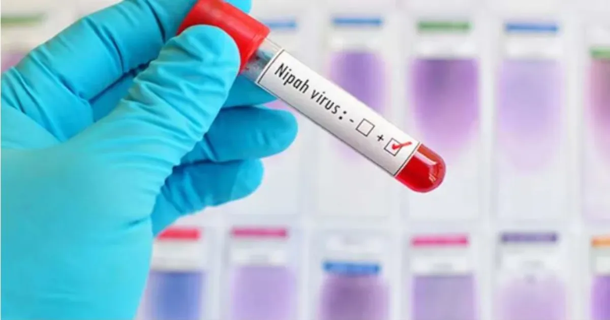 निपाह वायरस क्या है? क्या यह कोविड-19 जैसा है? पूरी जानकारी