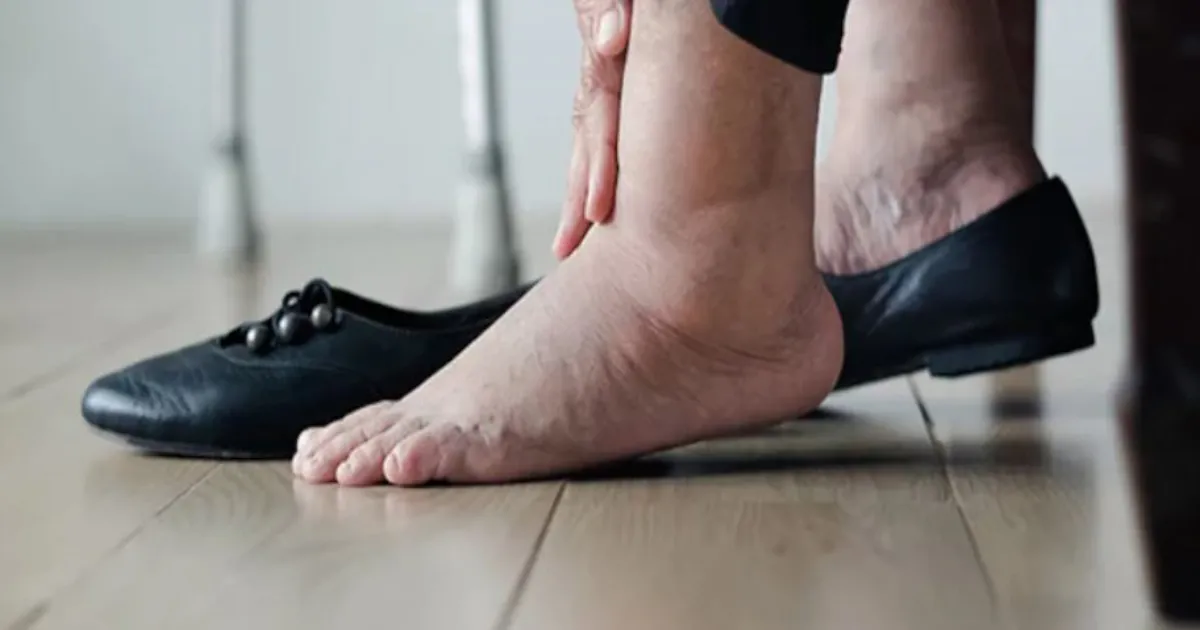 शरीर के इन हिस्सों में सूजन हो सकती है किडनी बीमारी का संकेत, समय पर जांच जरूरी