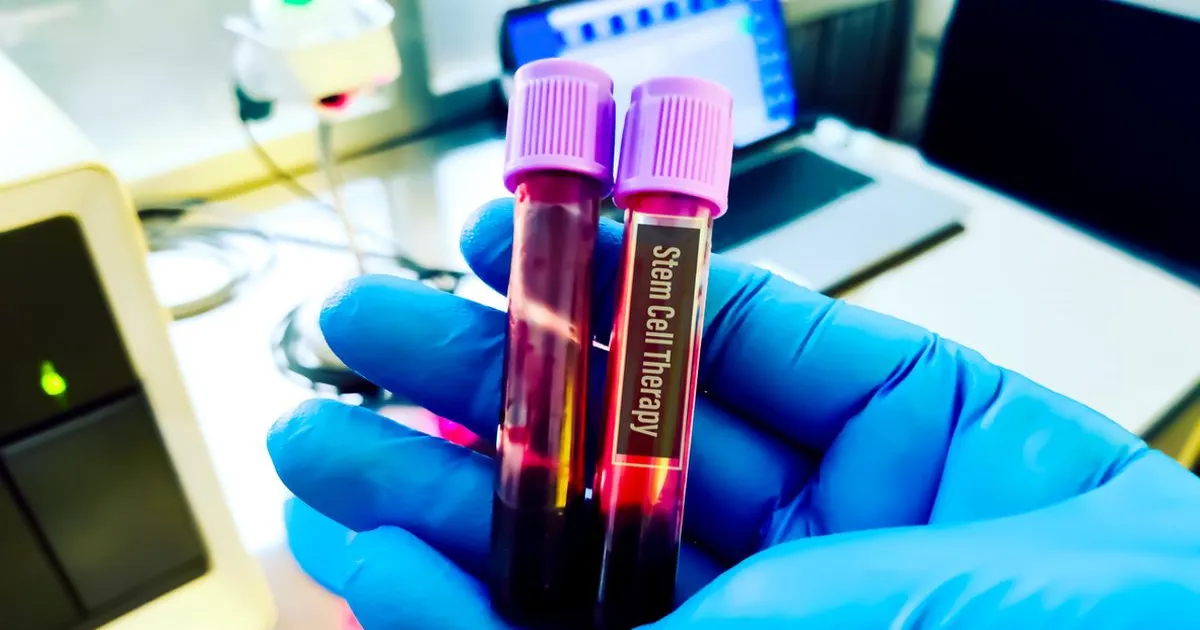 uoh-startup-successful-stem-cell-trials-liver-failure