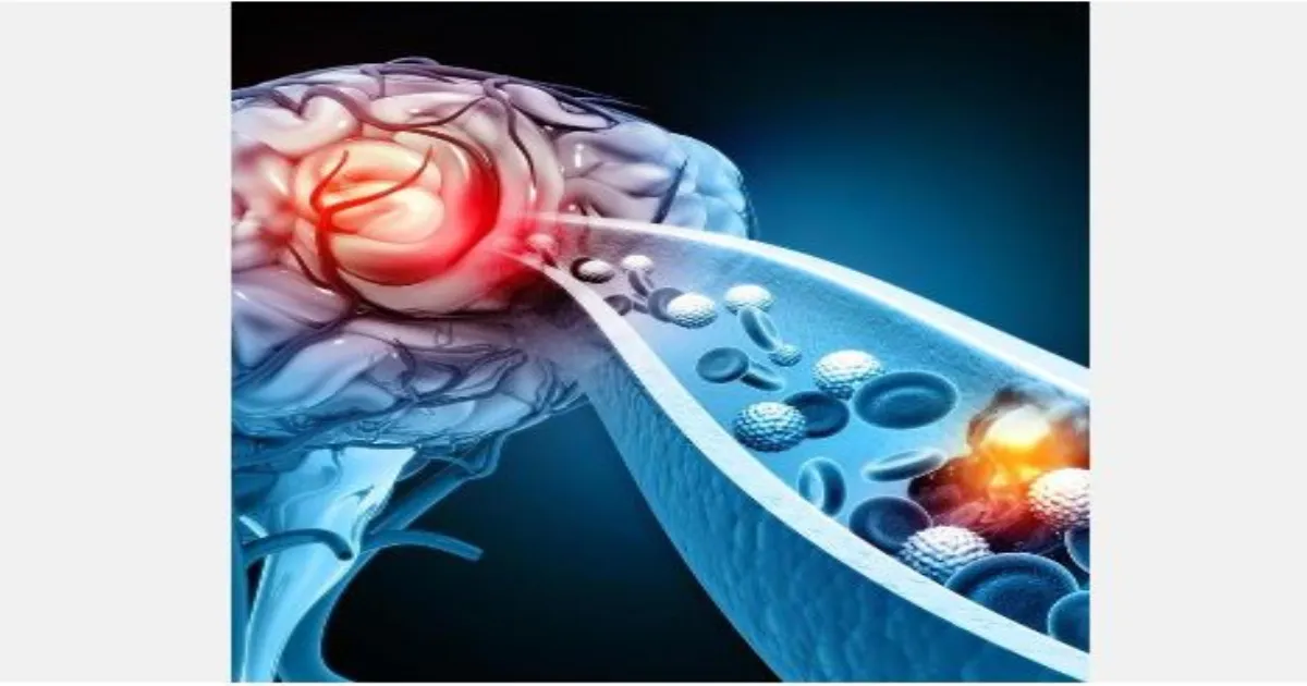 स्वदेशी स्ट्रोक डिवाइस को घरेलू ट्रायल डेटा के आधार पर मंजूरी, फरवरी 2026 में होगा लॉन्च